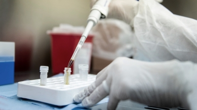 Coronavirus en Argentina: confirman 4.577 nuevos casos y otras 29 muertes en las &uacute;ltimas 24 horas
