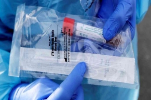 Comenz&oacute; la distribuci&oacute;n de 35 mil reactivos para diagnosticar coronavirus en todo el pa&iacute;s