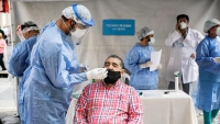 34 muertos y 1.303 nuevos contagios de coronavirus en Argentina