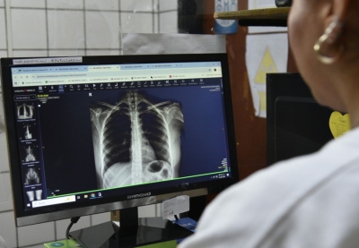 Jujuy dispone de ex&aacute;menes digitalizados en toda la red p&uacute;blica de salud