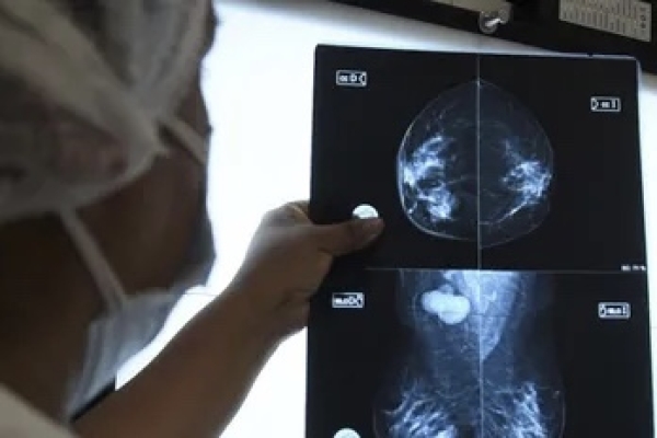 Mamograf&iacute;as a disposici&oacute;n en el Hospital de Humahuaca