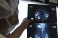 Mamograf&iacute;as a disposici&oacute;n en el Hospital de Humahuaca