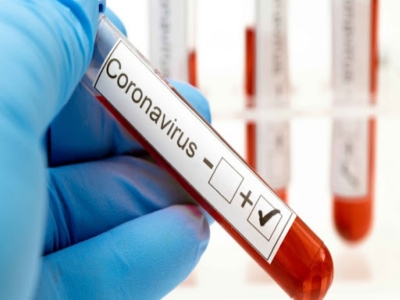 Dos casos positivos de coronavirus en Jujuy