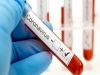 Dos casos positivos de coronavirus en Jujuy