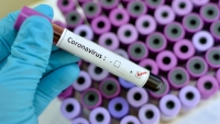 Cient&iacute;ficos israel&iacute;es podrian obtener una vacuna contra el coronavirus