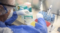 Bioqu&iacute;micos intervienen en el 70% de los diagn&oacute;sticos