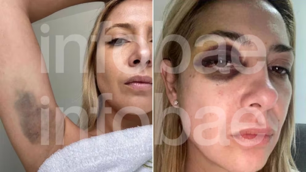 La denuncia de Fabiola Yañez contra Alberto Fernández: “Venís golpeándome hace tres días seguidos”