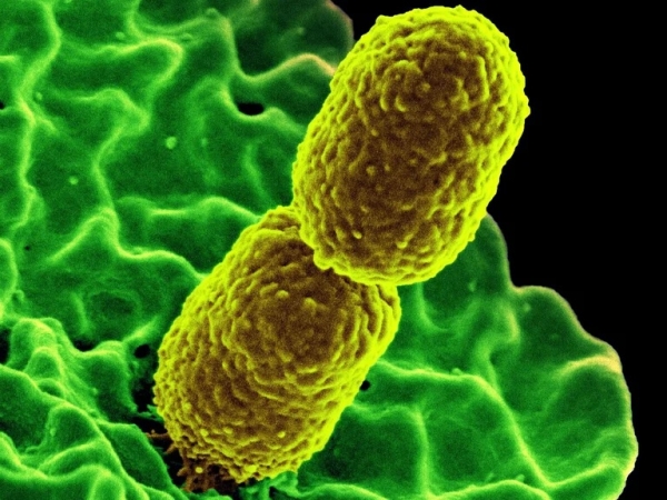 Por primera vez se detect&oacute; una superbacteria resistente a 30 antibi&oacute;ticos en pacientes de Argentina