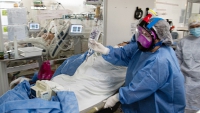 Murieron 733 personas y 22.195 fueron reportadas con coronavirus en las últimas 24 horas