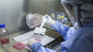 153 personas murieron y 9.405 fueron reportadas con coronavirus