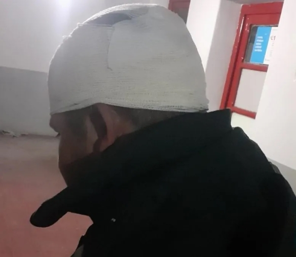 Humahuaca: Manifestantes agredieron al personal policial