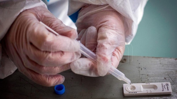 Anmat autoriz&oacute; el uso de test de autoevaluaci&oacute;n de Covid-19