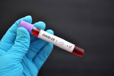 Jujuy report&oacute; 35 casos nuevos positivos de coronavirus y la cifra asciende a 178