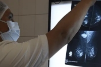 C&aacute;ncer de mama: con diagn&oacute;stico temprano la sobrevida alcanza al 90% de los casos